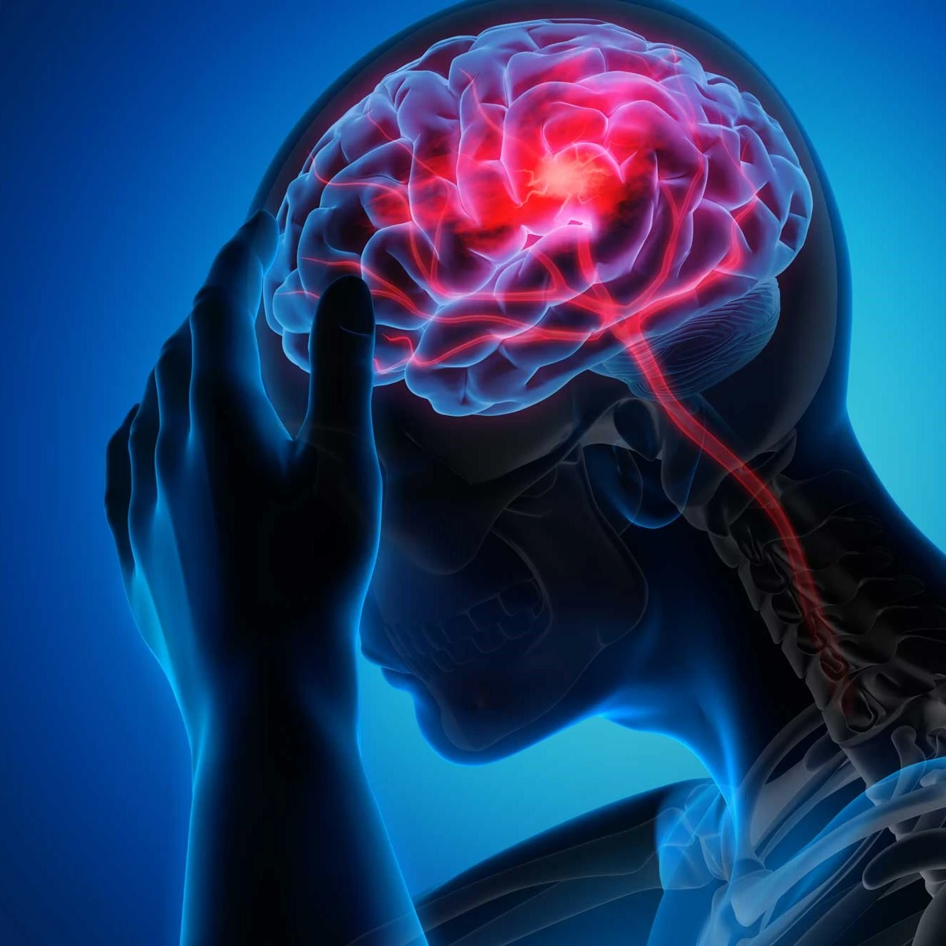 Céphalées et migraines